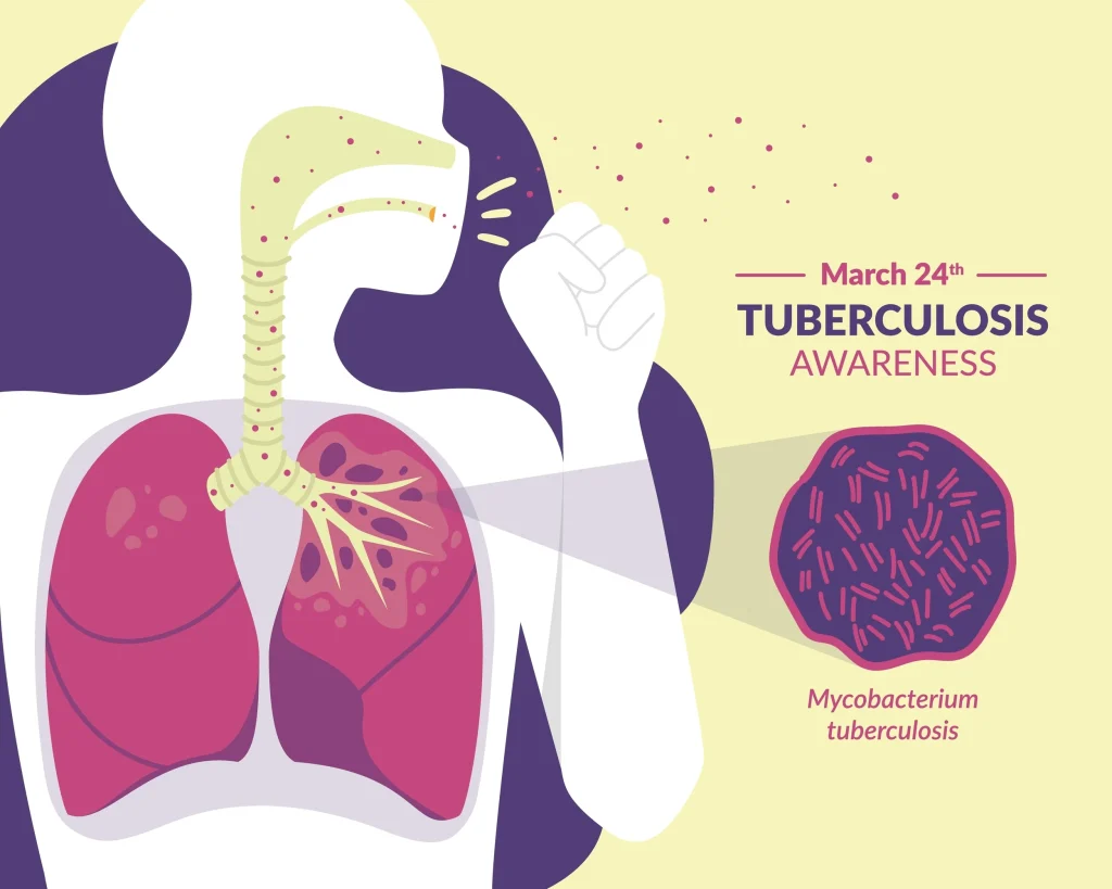 En el Día Mundial de la Tuberculosis, infórmate sobre su prevención, síntomas y tratamiento. Un diagnóstico a tiempo es clave para combatir esta enfermedad.
